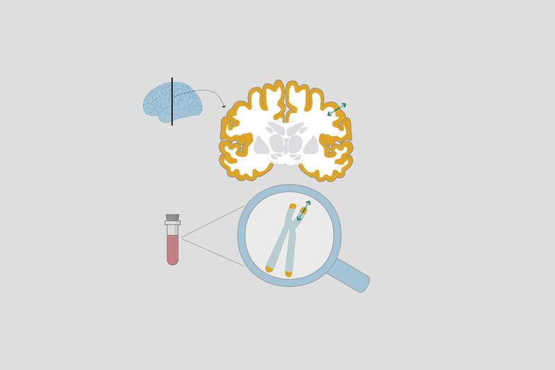 To determine the role of telomer length on brain structure scientists measured their length with the DNA of leukocytes from the blood using a polymerase chain reaction. 