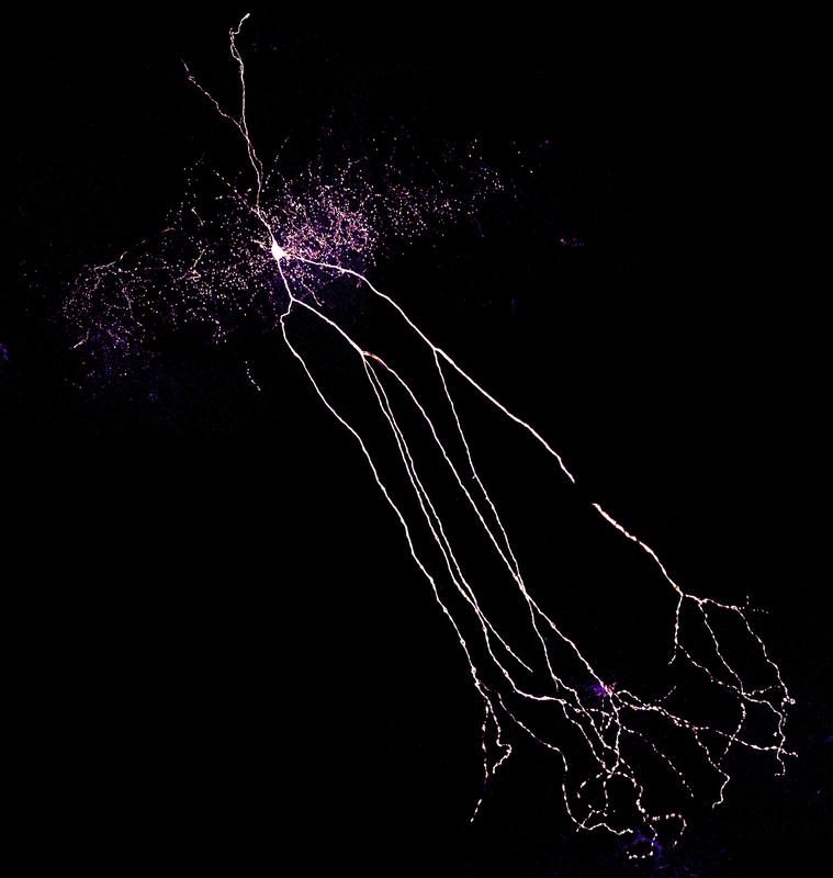 An interneuron (bright, with long appendages) from the hippocampus of a rat. The finely branched axon (top left cloud) surrounds the cell bodies of pyramidal cells and can inhibit these effectively.