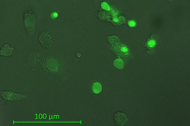 Bildunterschrift: Sogenannte Makrophagen, Fresszellen des Immunsystems, verschlingen Tumorzellen (grün eingefärbt).  