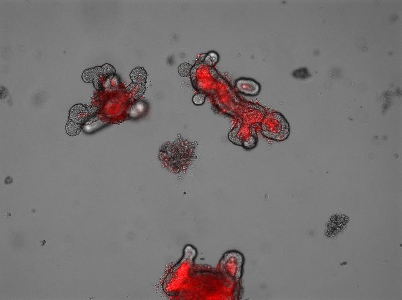 Viele der Untersuchungen erfolgten an sogenannten intestinalen Organoiden. Diese werden aus Stammzellen im Labor hergestellt und bilden quasi den Darm in der Petrischale nach.