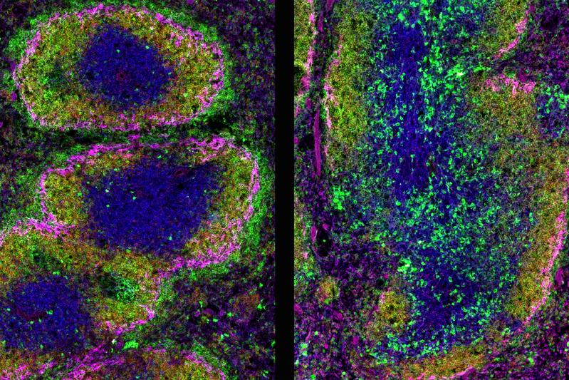 Querschnitt durch die Milz einer 10 Wochen alten Maus. Immunfluoreszenzfärbung.