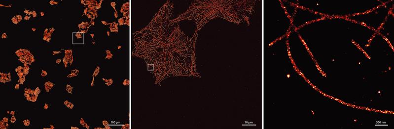 Die superauflösende Mikroskopietechnik DNA-PAINT ermöglicht die Detektion von feinen Strukturen in der Zelle, wie hier die Mikrotubuli, Bestandteile des Zytoskelettes.