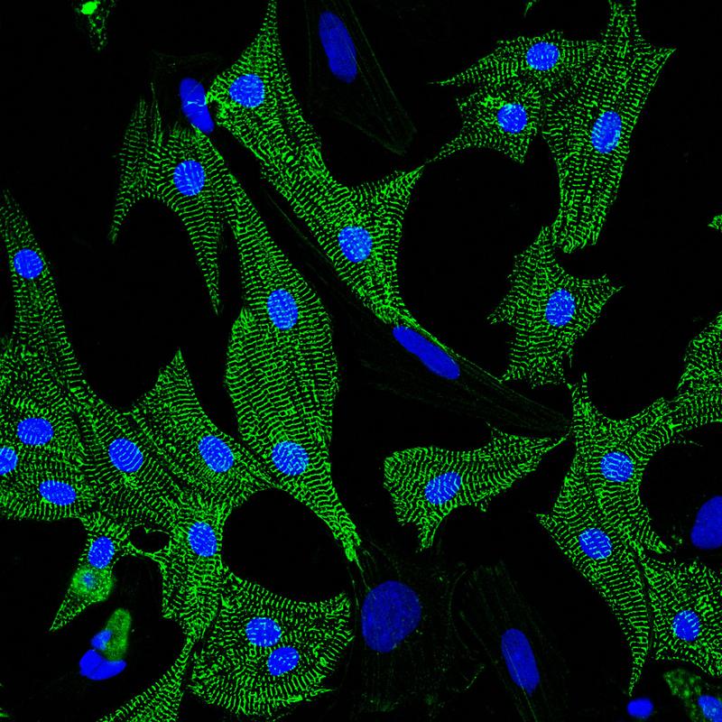 Herzmuskelzellen in der Kulturschale: grün eingefärbt die Sarkomere, die kleinsten funktionellen Einheiten des Muskels, in Blau die Zellkerne.