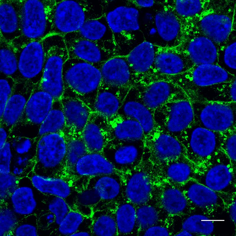 n den induzierten pluripotenten Stammzellen der Patientin befindet sich das Glut1-Protein vor allem im Zellinneren (grün markiert).