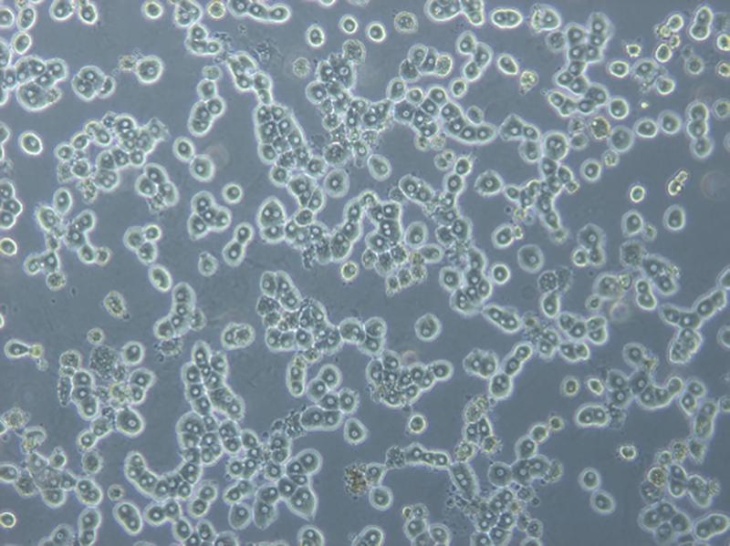 Human primary hepatozytes in vitro.