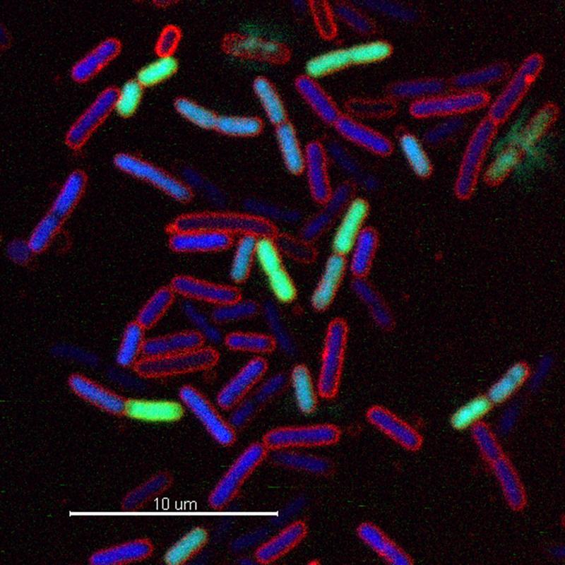 Escherichia coli-Bakterien, die mit dem neuartigen Antibiotikum behandelt wurden. Blaue Zellen sind lebendig, grüne Zellen wurden durch das Antibiotikum getötet (Zelllyse).