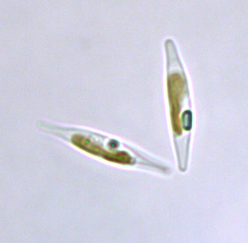 Unterm Mikroskop schaut sie unscheinbar aus, die Kieselalge Phaeodactylum tricornutum; versehen mit einem Bakterienenzym, vermag sie auch zum Abbau von Plastik beizutragen. 