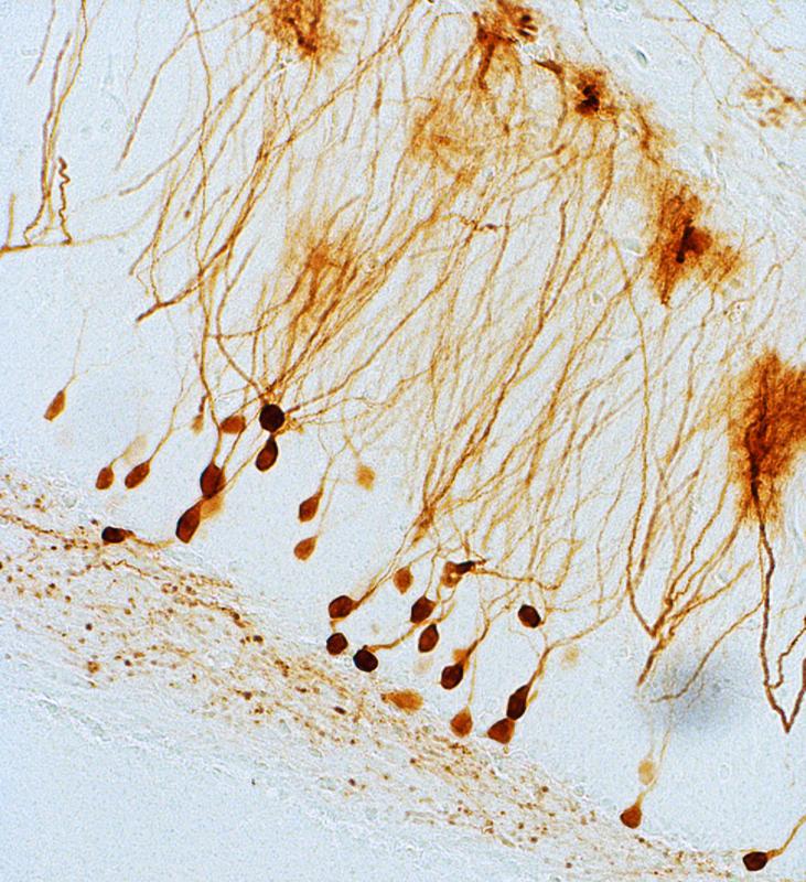 Nervenzellen im Hippokampus des Gehirns (Tiermodell). Für den neuen gentherapeutischen Ansatz wird hier ein zusätzliches Gen eingeschleust, sodass die Zellen bei Bedarf Dynorphin ausschütten.