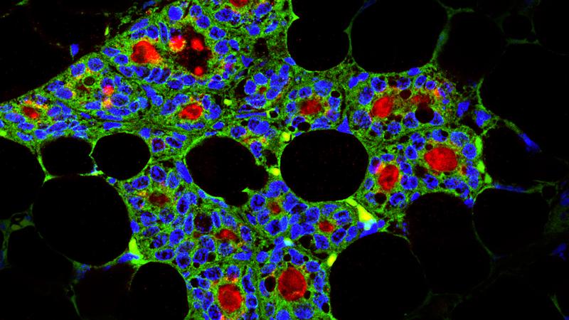 Schnitt durch eine Milchdrüse, die von dentalen Stammzellen erzeugt wurde (grün: Zahnepithelzellen, blau: Zellkerne, rot: milchspezifisches Protein Kasein).