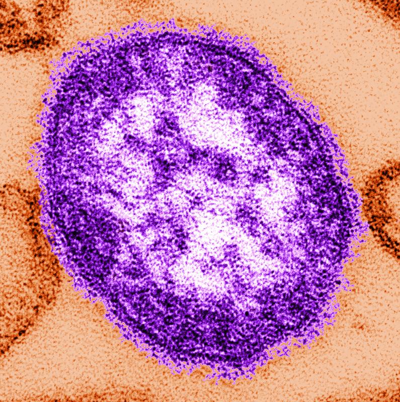 Measles virus