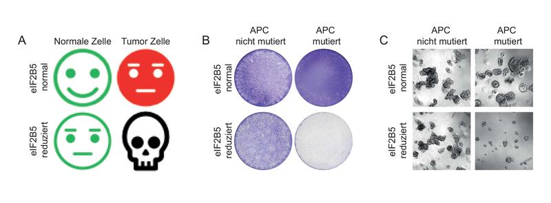  Wird das Gen eIF2B5 gehemmt, bekommt das Darmkrebszellen mit einer APC-Mutation nicht gut: Sie sterben ab. Links eine schematische Darstellung, in der Mitte Zellkulturen, rechts Organoide.