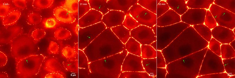 Entstehung der Gewebebarriere: Ein Protein, nötig für die Herstellung der Gewebebarriere, wurde mit fluoreszierendem Farbstoff markiert und mit Hilfe von Fluoreszenzmikroskopie live verfolgt.