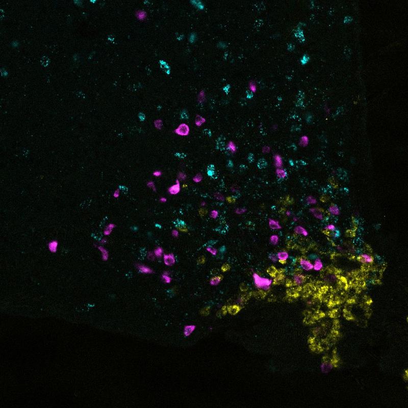 Im Hypothalamus sitzen mehrere Zelltypen, die die Nahrungsaufnahme regulieren (gelb: die von Jens Brüning untersuchten AgRP-Zellen, magenta: sogenannte POMC-Zellen, cyan: PNOC-ausprägende Zellen). 