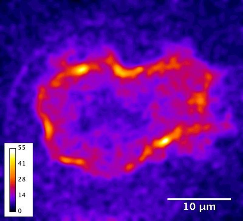 Aktive Kraftgeneratoren (Myosin), die Muster im Kortex einer zusammengedrückten, sich teilenden Zelle bilden 