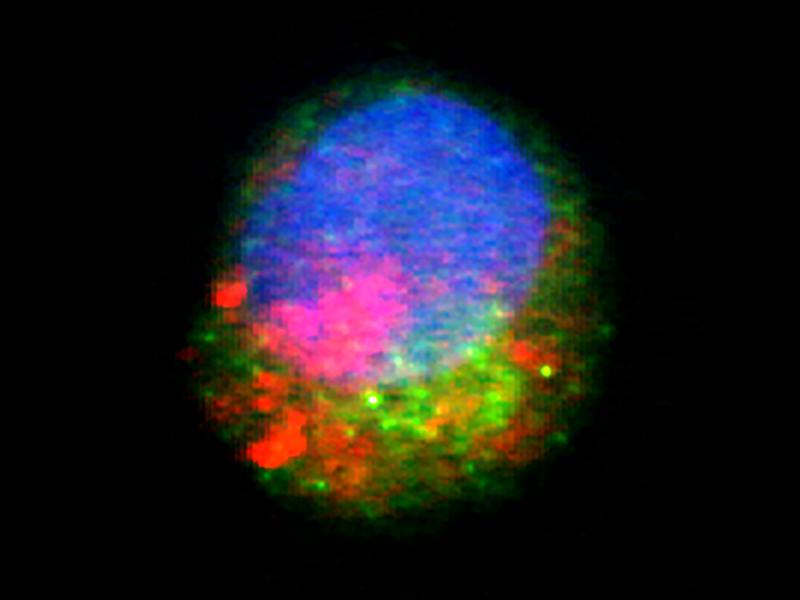 Propranolol disrupts autophagy  and activates inflammatory signal cascades in immune cells: The cell nucleus in blue, an autophagy marker in red and a protein activated by inflammation in green. 
