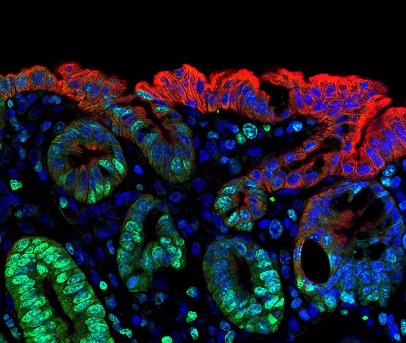 Wenn der Körper das Notfallprogramm aktiviert, übernehmen Zellen der Darmwandoberfläche (rot) die Funktion von tiefer liegenden Stammzellen (grün). Einige Zellen leuchten deshalb zweifarbig auf.