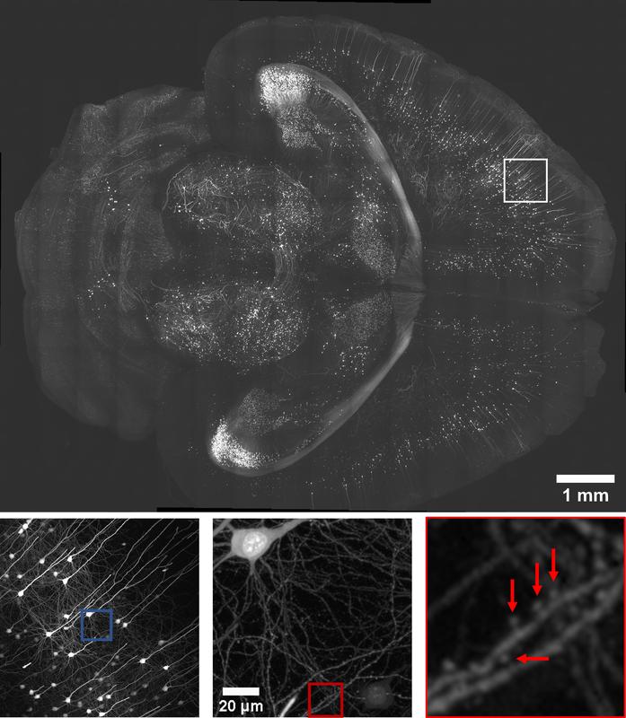 Eine X-Y-Ansicht eines Abschnitts 2,5 mm von der Oberseite eines Gehirns. Nahaufnahme mit einem gerenderten Neuron.