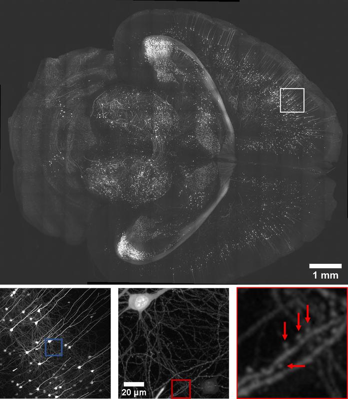 An x–y view of a section 2.5 mm from the top surface of a Thy1-eGFP PEGASOS-cleared brain. Close-up of the box with a rendered neuron. Insets provide magnified views of synaptic spines.