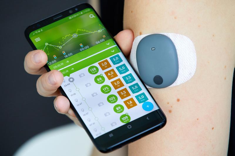 Der Transmitter ist durch ein Pflaster am Oberarm befestigt und überträgt die Blutzuckerwerte, die der implantierte Sensor unter der Haut misst, auf das Smartphone. 