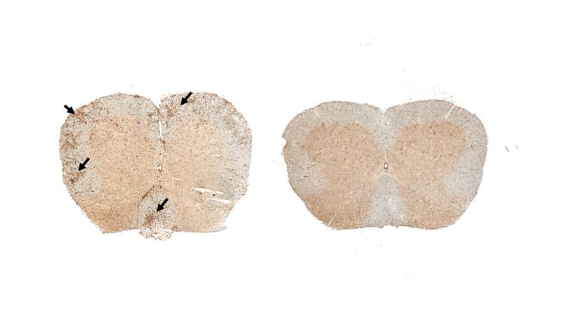 Das Rückenmark ist bei den Mäusen mit MS-Symptomen stark entzündet (links, Immunzellen braun).Tryptophan-freie Diät verhindert diese Infiltration der Entzündungszellen in das Rückenmark (rechts).