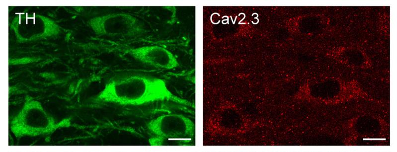 Antikörper-Färbung von Dopamin-produzierenden Nervenzellen der Maus (grün). Die Cav2.3 Kanal-Proteine in den Zellen sind rot gefärbt. Maßstab: 10 µm