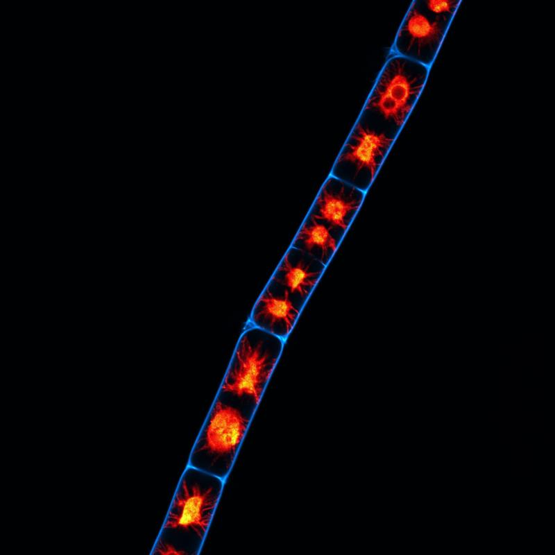 In der Jochalge Zygnema circumcarinatum fand das Forschungsteam ein Gen, das bei der Stressbewältigung eine Rolle spielen könnte. 