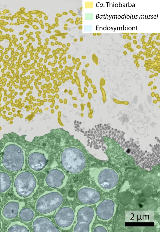 Eingefärbtes Bild aus dem Transmissionselektronenmikroskop; Bathymodiolus-Gewebe in Grün; Zellen von Ca. Thiobarba, die außerhalb der Wirtszellen leben, in Gelb. 