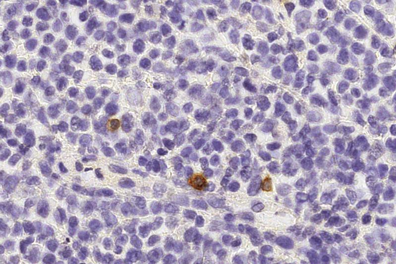 NK-Zellen (braun) patrouillieren zwischen Zellen eines gesunden menschlichen Lymphknotens. 