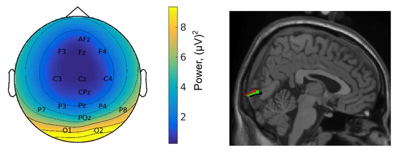 Topographie der EEG-Antwort (l.) und ihre Lokalisation im Gehirn (r.) zeigen visuelle Verarbeitungsprozesse bei den Bewegungsbedingungen langsames und normales Gehen – grün und rot; Stehen – schwarz.