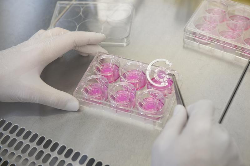 In vitro gezüchtete natürliche Organmodelle – wie das abgebildete Hautmodell – können in Zukunft helfen, Tierversuche bei der Entwicklung von Medikamenten zu vermeiden. 