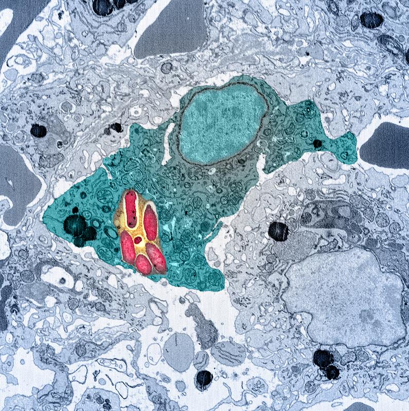 Electron microscope image of a macrophage (blue) infected with Salmonella (red).