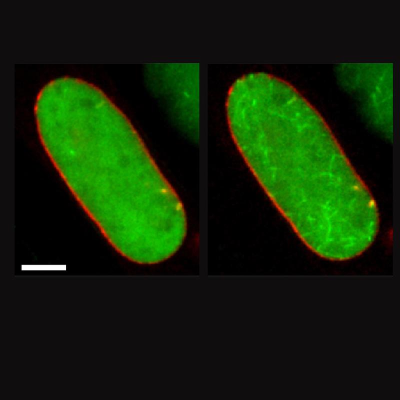 After the cell has been treated with a messenger substance (right), the green actin molecules in the red cell nucleus (left) form actin filaments that structure the genome. 