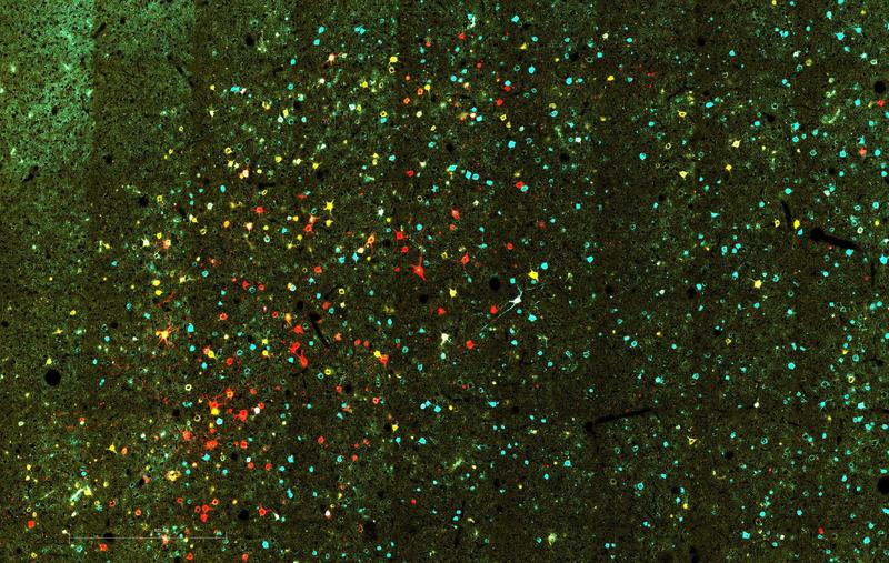 Blick ins Gehirn. Pyramidenbahn-Neurone im Neokortex der Ratte. Die Farben spiegeln die unterschiedlichen Hirnregionen wieder, die in diese Zellen die Ergebnisse neuronaler Berechnungen.