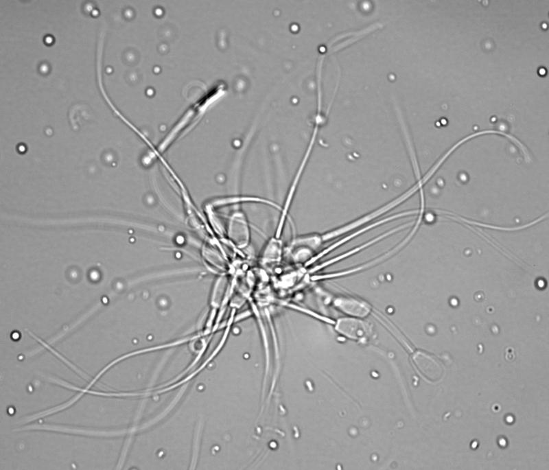 Rinderspermien in Hellfeldmikroskopie mit Differentialinterferenzkontrast.