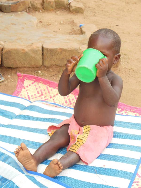 Malnutrition is a widespread problem in Africa.
