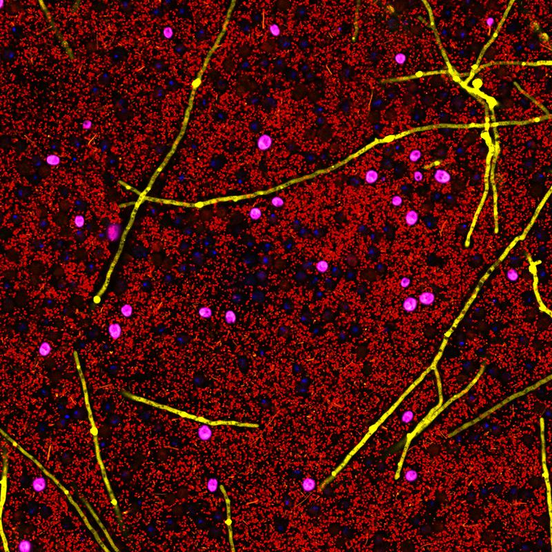 Positive effects of exercise in diabetes prevention are determined by the patient’s gut microbiome.