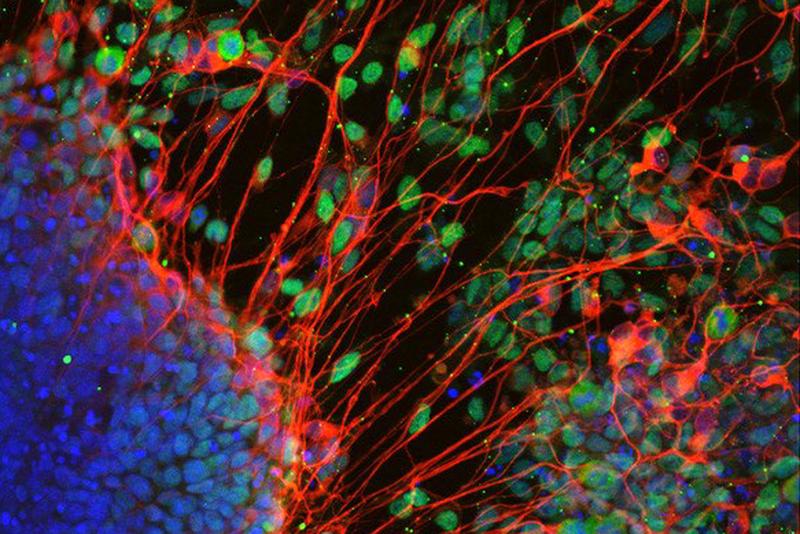 Aus Stammzellen erzeugte Neurone in der Abwesenheit von T-Box Faktoren. 