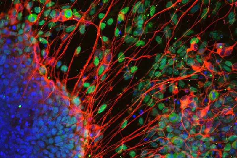 Neurons derived from stem cell in the absence of T-Box factors. 