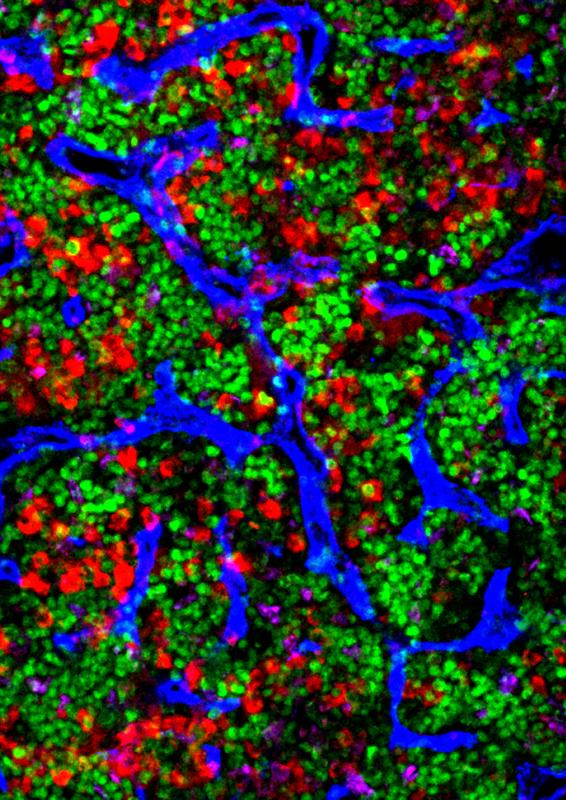 Mikroskop. Aufnahme von altem Knochenmark. Zu sehen sind Blutgefäße (blau) sowie bestimmte Marker, die eine erhöhte Zellteilungsaktivität anzeigen (grün) sowie hämatopoetische Stammzellen (rot)