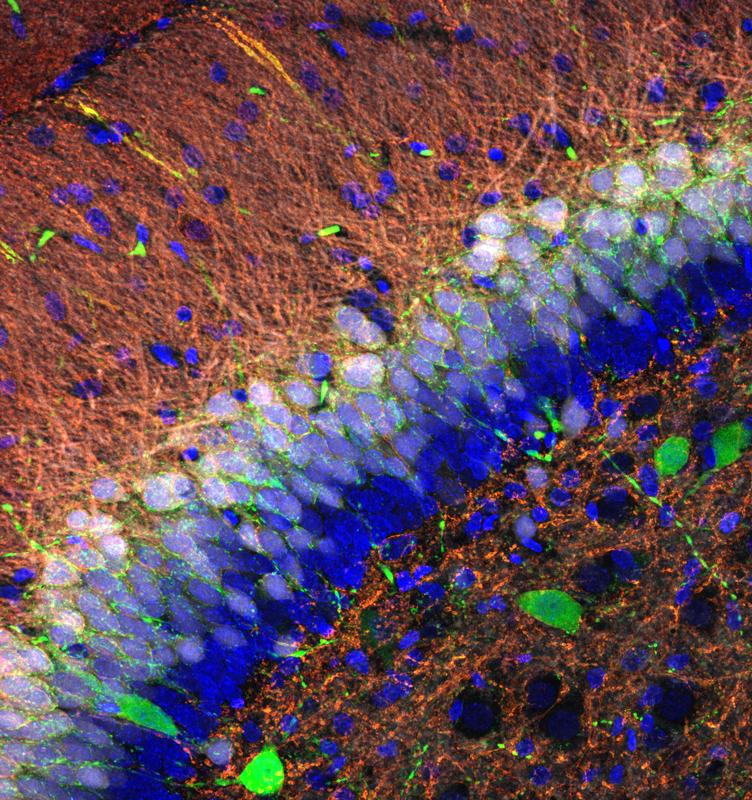  Körnerzellen (blau) verarbeiten und verschlüsseln Informationen und fügen sie zu einer Art Karte im Gyrus Dentatus zusammen. 