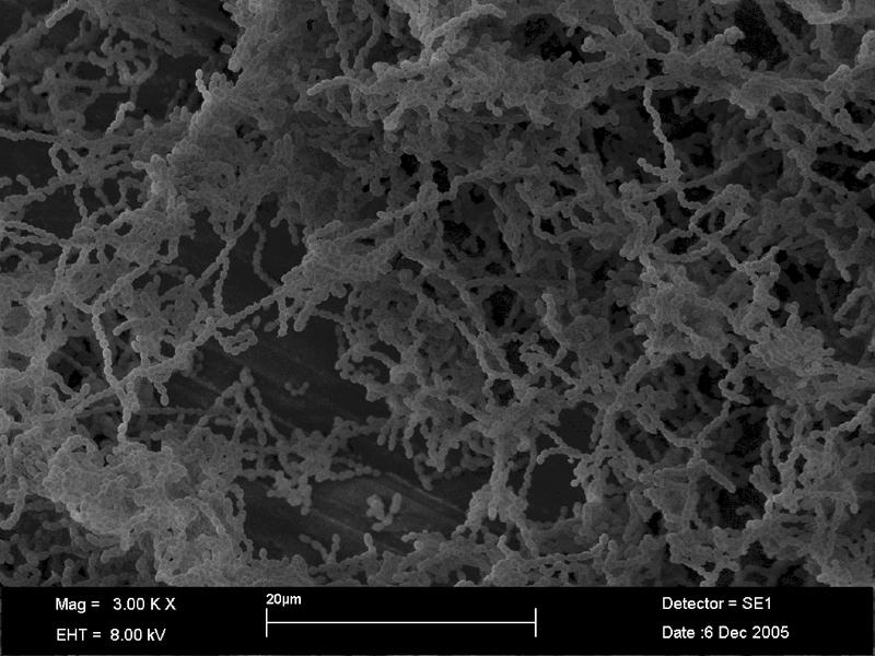  Bildunterschrift: Auch der Hauptverursacher von Karies, Streptococcus mutans, kann Resistenzen gegen das Antiseptikum Chlorhexidin bilden.