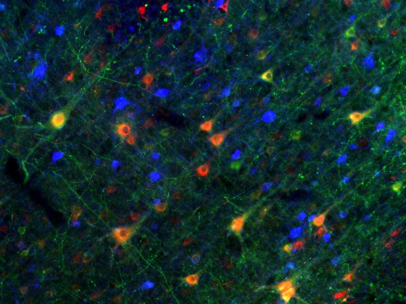 Stained nerve cells in the pre-motor cortex of a rhesus monkey. 