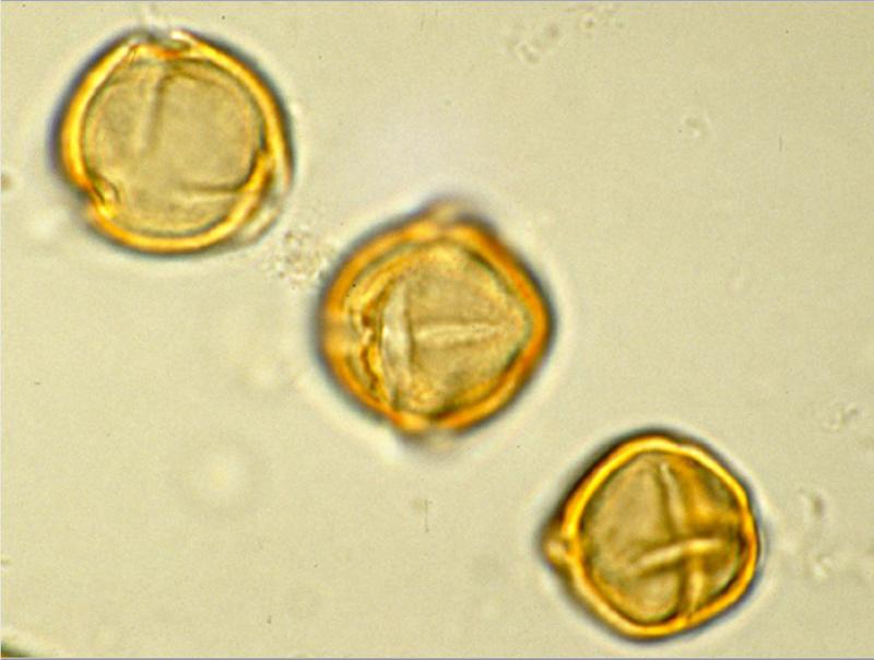 Pollen unter dem Mikroskop: Der im Sediment konservierte Pollen ermöglicht es, vergangene Ökosysteme und die Klimadynamik zu enthüllen.