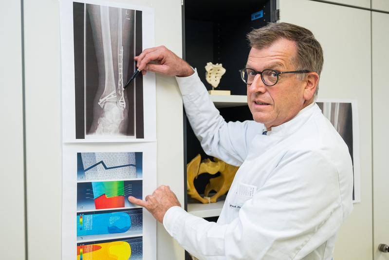 Professor Tim Pohlemann will mit einem Team aus Medizinern, Materialforschern, Ingenieuren und Informatikern der Universität des Saarlandes die Therapie komplizierter Knochenbrüche revolutionieren.