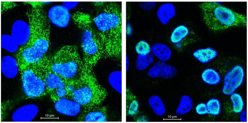 Mikroskopische Aufnahme menschlicher Zellen nach Infektion mit Grippeviren. Der Zellkern ist blau, virale Proteine sind grün dargestellt.