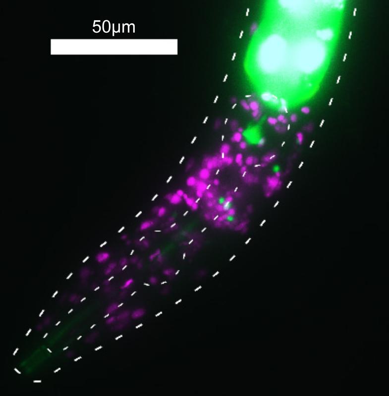 Mittels fluoreszierender Moleküle zeigte das Team um Henrik Bringmann, welche Gene in Schlafneuronen des Fadenwurms aktiv sind.
