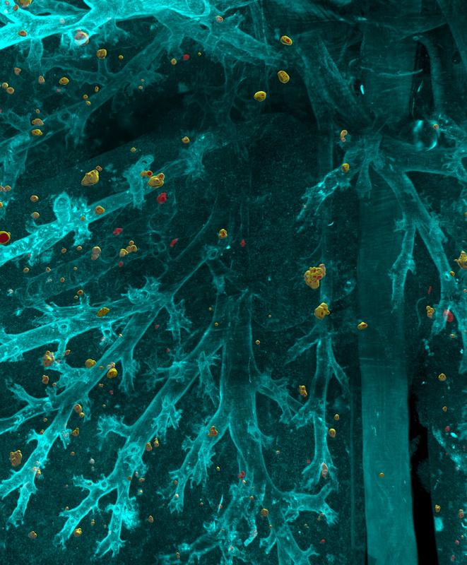 DeepMACT nutzt künstliche Intelligenz, um selbst kleinste Metastasen im gesamten Mauskörper zu erkennen. Im Bild sind einzelne disseminierter Zellen in der Lunge zu sehen.