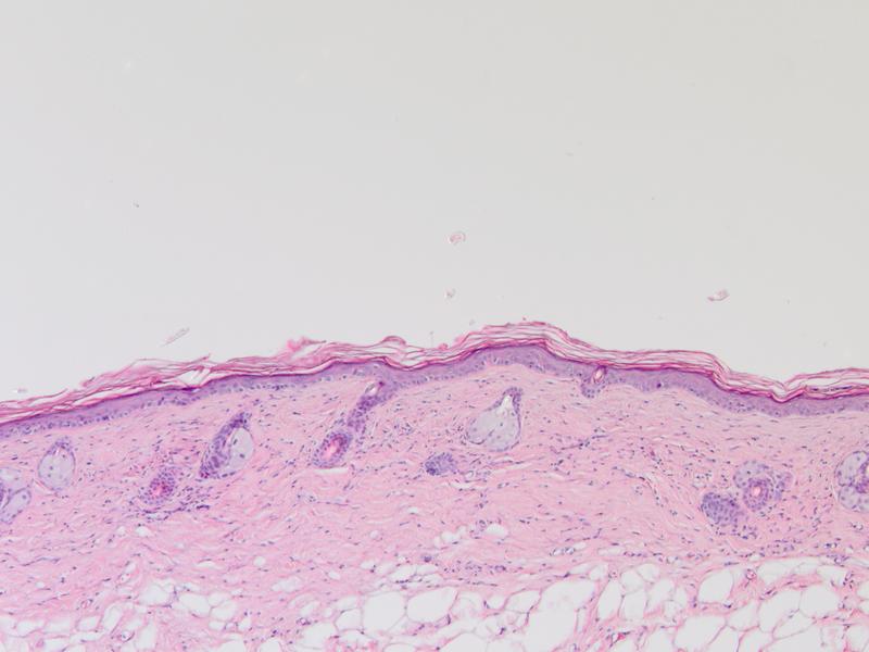 Abb. 1: Histologische Färbung gesunder Maushaut. Vergrößerung 100 x