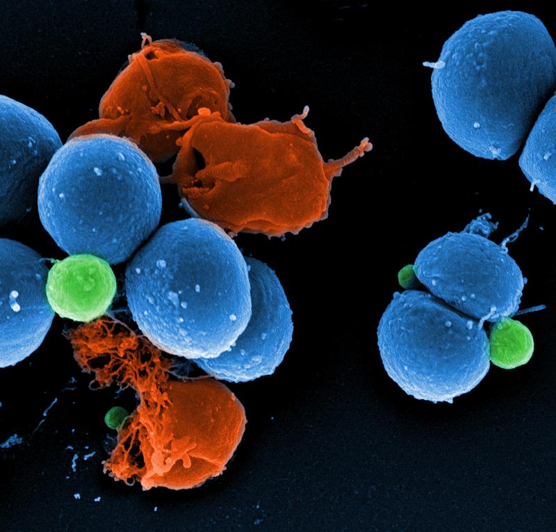 Rasterelektronenmikroskopische Aufnahme von intakten MRSA (blau), durch die Wirkung von PK150 induzierte Vesikelbildung (grün) und durch PK150 zerstörte MRSA (rot).