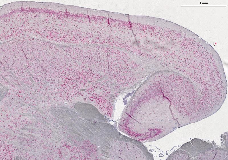 Der Nachweis von PIANP mittels In-situ-Hybridisierung an einem Schnitt im Bereich des Großhirns zeigt: PIANP (in rot) kommt in zahlreichen Nervenzellen (Neuronen) des Zentralnervensystems vor.